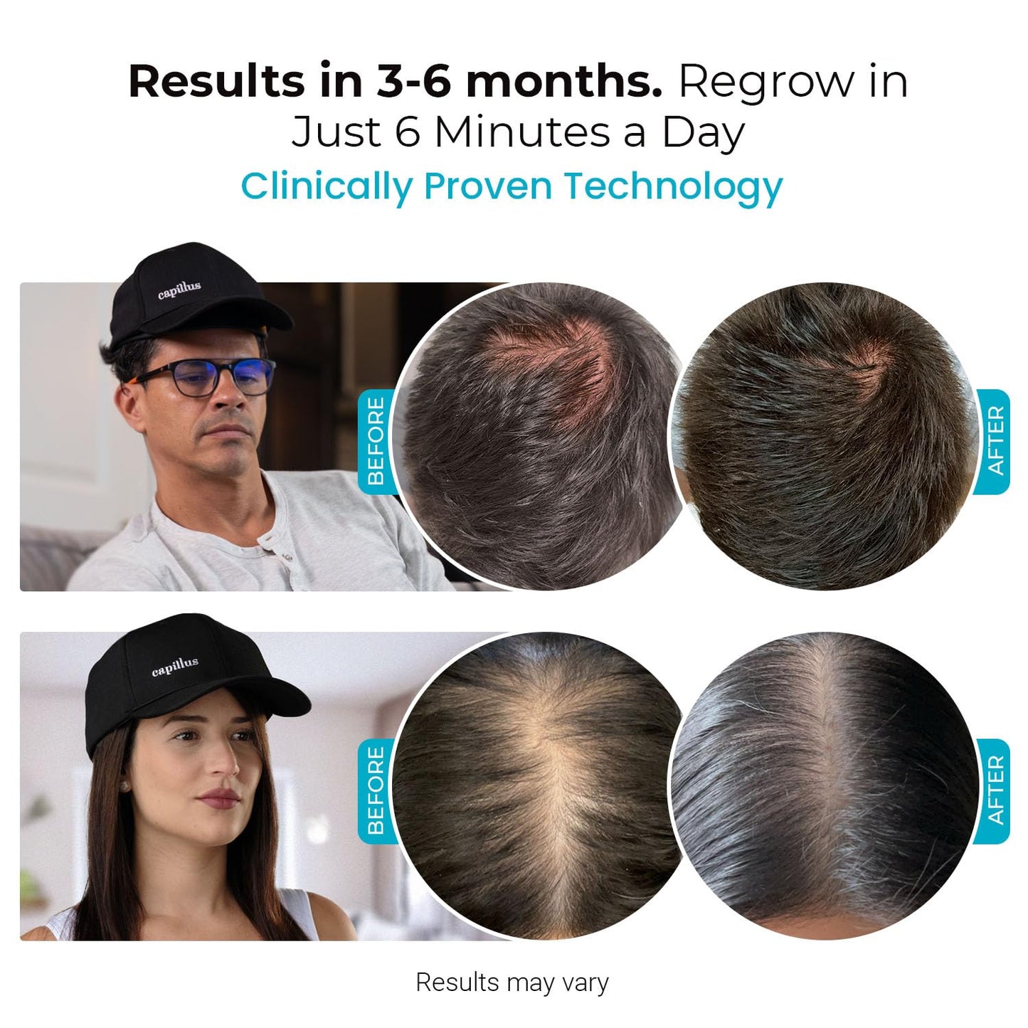 SPECTRUM Laser Red Light Therapy Cap - Red Light Hat, 312 Laser Hair Growth Cap, Laser Cap for Hair Regrowth, Hair Thinning, Red Light Therapy for Hair Growth, LLLT + Bluetooth, FDA Cleared