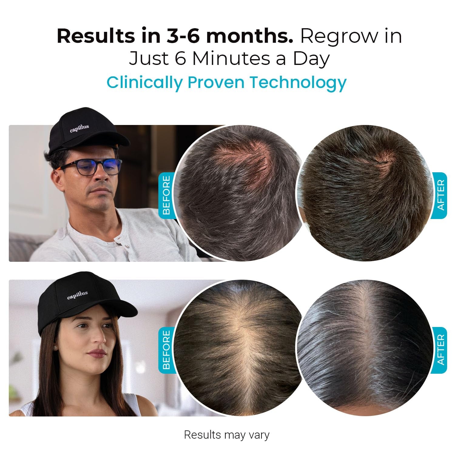 SPECTRUM Laser Red Light Therapy Cap - Red Light Hat, 312 Laser Hair Growth Cap, Laser Cap for Hair Regrowth, Hair Thinning, Red Light Therapy for Hair Growth, LLLT + Bluetooth, FDA Cleared